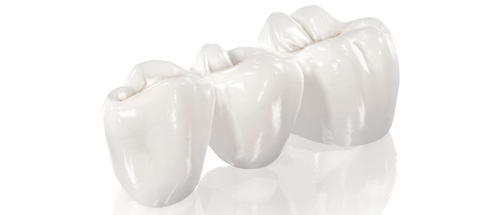 Клиновидные дефекты зубов