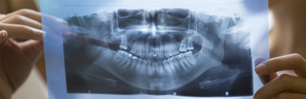 Ортопантомография