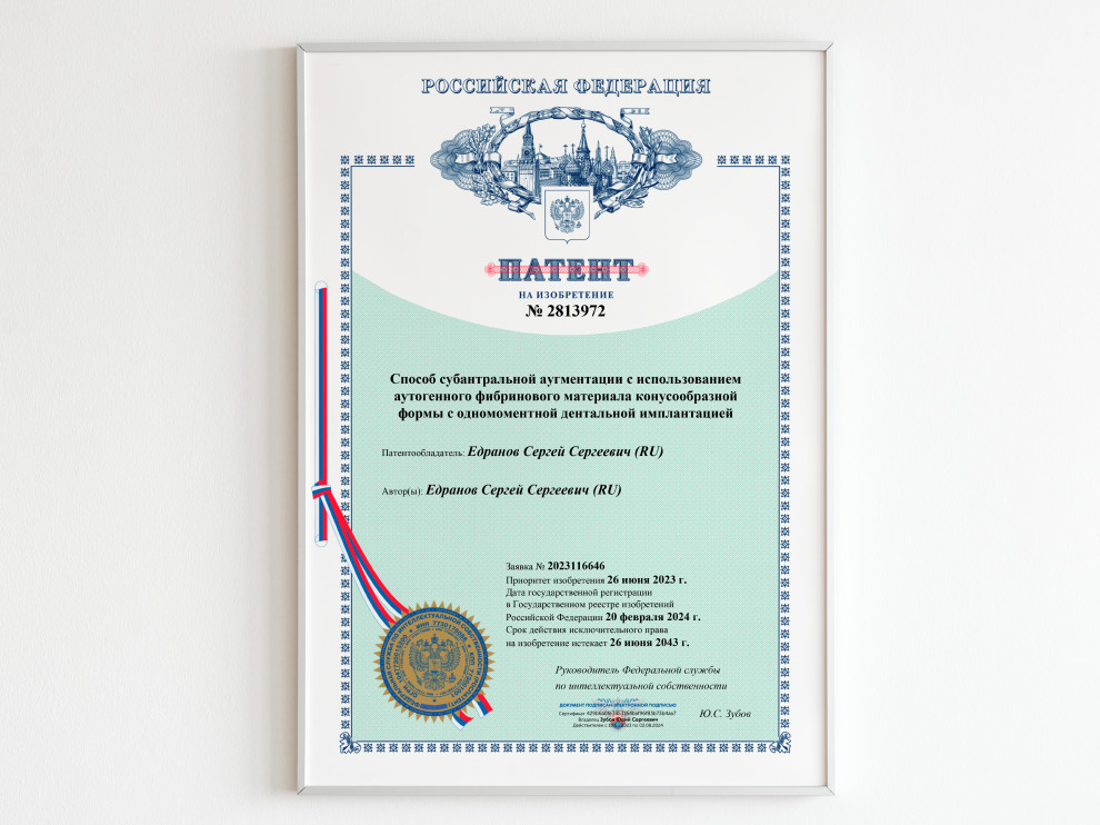 Сегодня Сергей Сергеевич Едранов получил 18-й патент!